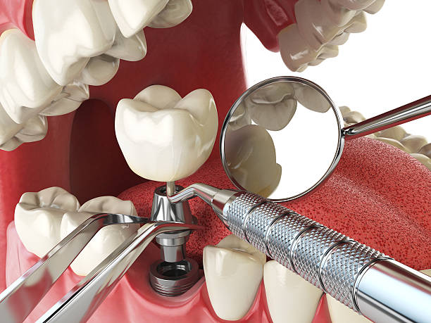 Best Emergency Dental Extractions in Stewartstown, PA